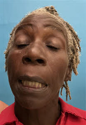 MugShot